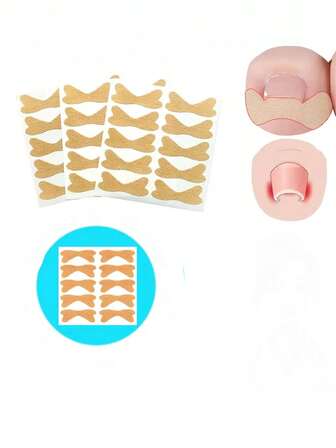 10片/套指甲矫正贴纸，无痛改善嵌甲，无异味蝴蝶形，男女通用，精致小礼物