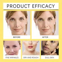 OUHOE Advanced Snail Mucin 96% Skin Care Routine Set, 4-Piece Korean Facial Kit With Whitening Serum, Moisturizer Facial Cream, Cleanser & Eye Mask To Fade Fine Lines, Repair And Firm Skin, Ideal Gift Set For Women - 白色 - 查看 10