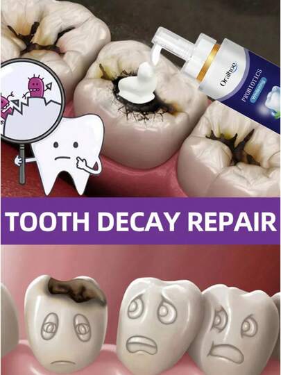 Anti Tartar Toothpaste Repair Cavities Remove Yellow Teeth Improve Brightness Protect Enamel Soothing Sensitive Gum Toothpaste