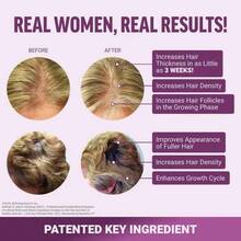 Hair Growth Accelerator With Clinically Proven To Promote Thicker, Stronger Hair, Biotin,Vitamin E & C, Mixed Berry, 60 Silicon - 2 chiếc - Xem 3
