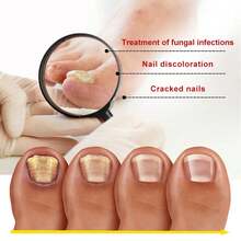 Daily Nail Care Enhancement, A Tool To Protect Fingertip Health - 5ml Boxed - View 5