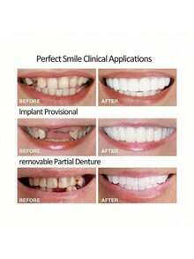 1pc Silicone Smile Teeth Veneers, Soak In Hot Water To Soften Before Applying On Upper & Lower Teeth - Multicolor - View 3
