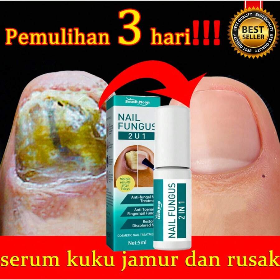 Daily Nail Care Enhancement, A Tool To Protect Fingertip Health