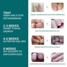 Daily Nail Care Enhancement, A Tool To Protect Fingertip Health - 5ml Boxed - View 3