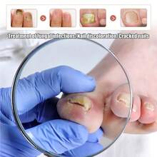 Daily Nail Care Enhancement, A Tool To Protect Fingertip Health - 5ml Boxed - View 6