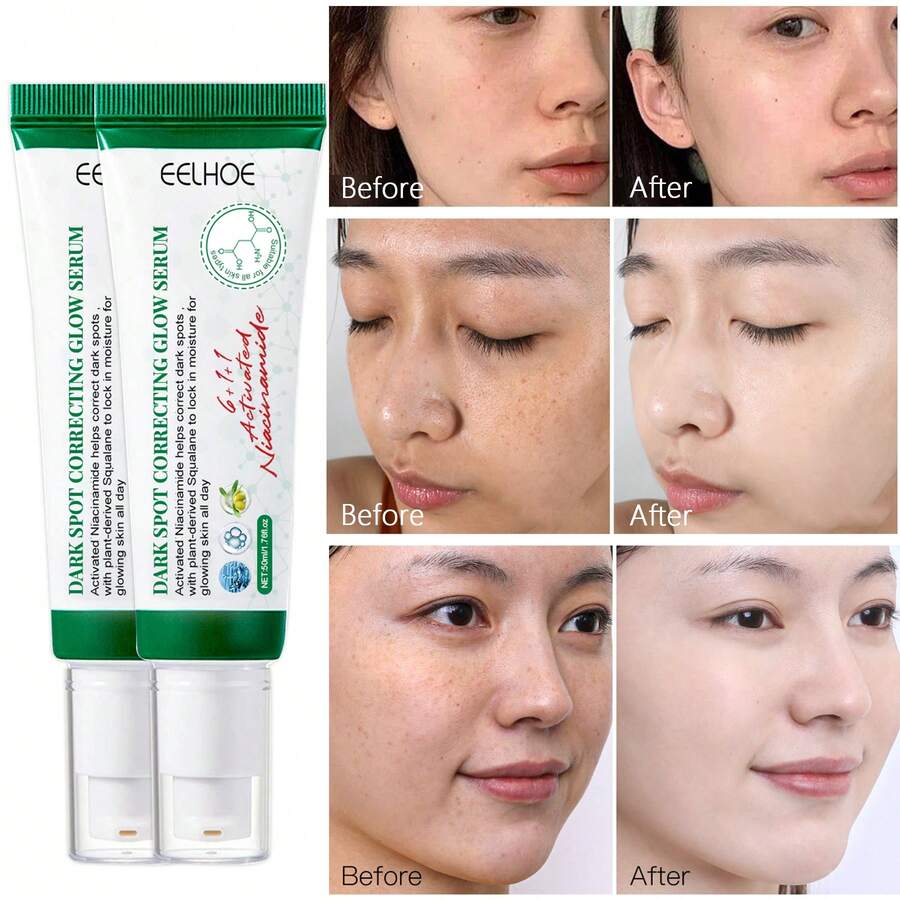 EELHOE 2件組 亮白淡斑精華液 含菸鹼醯胺與甘油,淡化黑斑、雀斑與細紋,均勻暗沉膚色,提亮氣色,舒緩修復肌膚,保濕柔軟,適合所有膚質 - 白色 - 查看 1