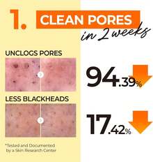 numbuzin Aceite de Limpieza No.1 Easy Peasy 200 ml| Limpieza, calmante e hidratación de origen natural. - 1 - Ver 5