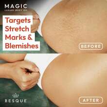 Besque Magic Body Oil, 3.38 FL OZ, After Shower Body Oil For Women, Hydrating Skin Care For Full Body That Plumps, Tightens, And Firms Skin With Natural Ingredients, Luxury Spa Gifts - Pack Of 1 - 1 - View 5