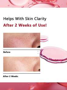 Anua 10%烟酰胺+4%氨甲环酸精华液，轻盈保湿配方，淡化瑕疵，改善暗沉，功能性护肤，韩国化妆品，30毫升/1.01液盎司 - 30ml /1.01 fl.oz - 查看 2