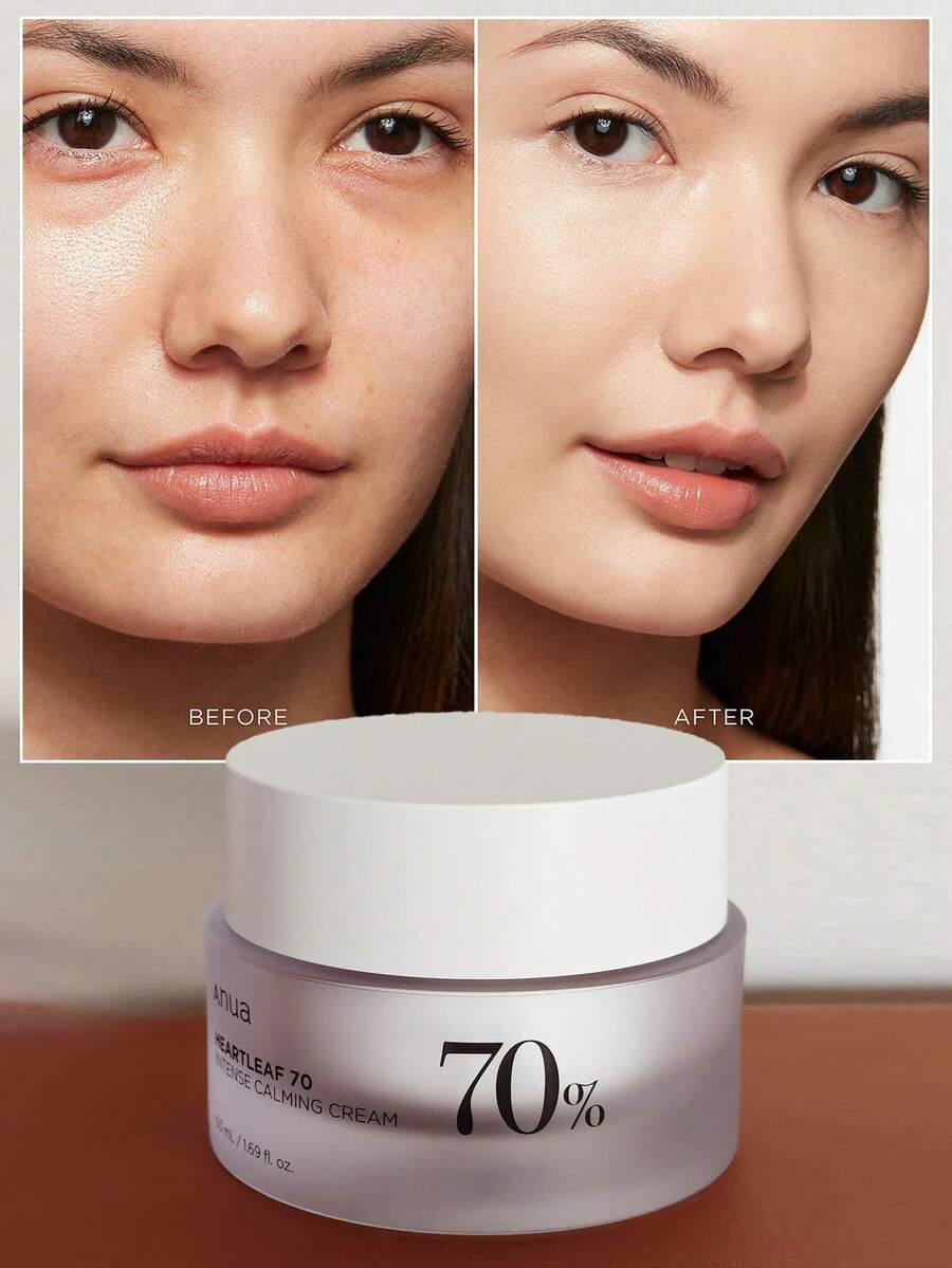 ANUA 心叶 70 强效舒缓霜，含神经酰胺、泛醇、心叶提取物，韩国护肤品 50ml - 鎮靜乳霜 - 查看 1