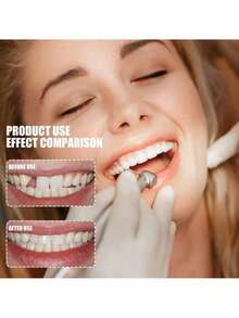 2片装临时牙贴套装，美白替换牙，微笑牙齿修复套装 - 彩色 - 查看 5