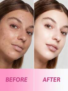 Pond's Ponstel 烟酰胺精华霜，14天淡化色斑，提亮肤色，平衡肤色，锁住水分，修复肌肤屏障，舒缓泛红，质地轻盈，不留残余，非常适合妆前使用，98%纯度B3，面霜，早晚护肤/国际妇女节礼物，适合易长痘肌肤、夜猫子、肤色暗沉人群，晨间护肤，夜间修护，节日礼物，旅行装。 - 23克 - 查看 2