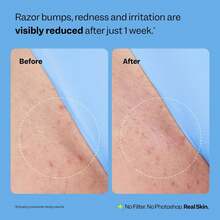 Smoothing Solution Ingrown Hair Treatment (1.69 Oz) - Smooth, Relieve, Soften Skin - 360 Roller - BHA, AHA, PHA, Niacinamide, Licorice - Vegan & Cruelty Free - Korean Skin Care & Beauty - 藍色 - 查看 8