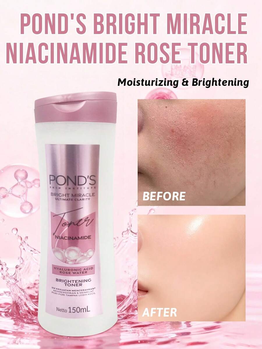 Pond's Ponstel 亮白奇迹烟酰胺玫瑰爽肤水，提亮肤色，保湿补水，平衡油脂，柔嫩肌肤，舒缓泛红，蕴含98%烟酰胺和玫瑰精华，瞬间融入肌肤，温和不刺激，妆前使用效果极佳，72小时深层保湿，双重清洁，面部爽肤水，早晚/节日/国际妇女节礼物，适合干性及敏感性肌肤，夜猫子适用，学生预算友好，晒后修复面膜，办公补水，旅行应急，节日礼物 - 150ml - 查看 1