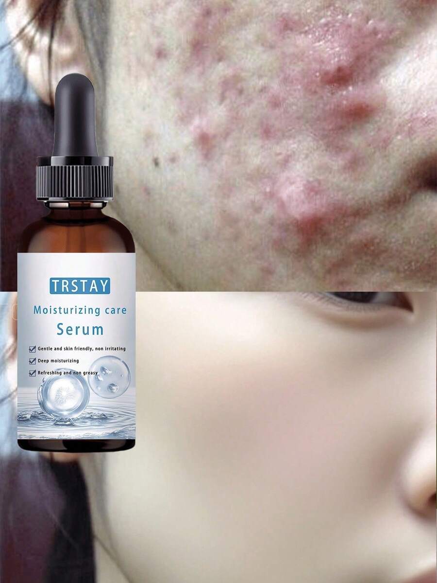 TRSTAY Facial Moisturizing Essential Oil, Refreshing And Non Greasy, Suitable For All Skin Types - 彩色 - 查看 1