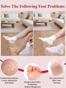 5双装足部去角质面膜，玫瑰足部去角质去角质，去除死皮并滋润护理，不含酒精，富含透明质酸和甘油，缓解干燥皲裂的脚后跟，软化粗糙的足部SPA袜，秋冬季皲裂足部护理，圣诞礼盒装（男女通用）