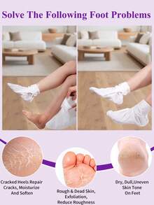 5双装足部去角质面膜，去除死皮并滋润护理，不含酒精，富含透明质酸和甘油，缓解干燥皲裂的脚后跟，软化粗糙的足部SPA袜，秋冬季皲裂足部护理，圣诞礼盒装（男女通用）