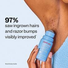 Smoothing Solution Ingrown Hair Treatment (1.69 Oz) - Smooth, Relieve, Soften Skin - 360 Roller - BHA, AHA, PHA, Niacinamide, Licorice - Vegan & Cruelty Free - Korean Skin Care & Beauty - 藍色 - 查看 7