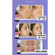 Dúo Quita Manchas, Espuma Limpiadora + Gel Anti-manchas. ADECUADO PARA TODOS LOS TIPOS DE PIEL.  Simplemente aplícalo a diario y sorpréndete con los resultados notables que obtendrás DESDE LA PRIMERA SEMANA.