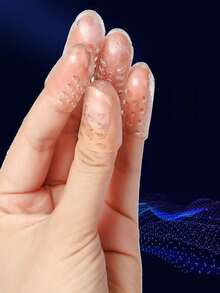 Silikon Schuh Zehen Anti-Reibung atmungsaktive Zehen Protektoren Isolierung, Galentines, Welpe, Karneval