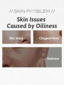 The Ordinary Niacinamide 10% + Zinc 1% Serum Minimize Pores, Regulates Sebum, Blemish Minimization, 1pc 30ml 1.01 Fl Oz, Lightweight Gel Texture, Easily Absorbed, Oil-Free Formula, Fragrance-Free, High-Strength Vitamin Formula, Vitamin B3 And Zinc Complex - 30ml - View 2