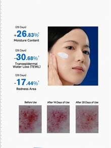 Uriage Kem phục hồi làm dịu đa tác dụng Yiquan - Kem băng bó B5, Kem dưỡng ẩm và nuôi dưỡng da mặt, Kem dưỡng phục hồi và làm dịu mẩn đỏ - Kem phục hồi dịu nhẹ 100ml - Xem 5