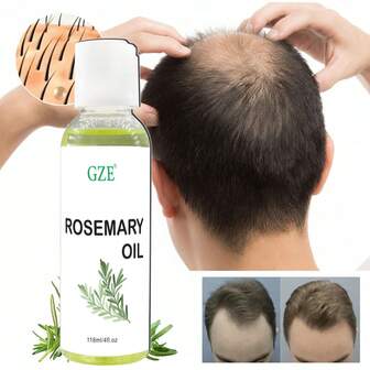 GZE 头皮迷迭香油，适用于头发分叉 | 强韧秀发护理 | 男士滋养丰盈精油