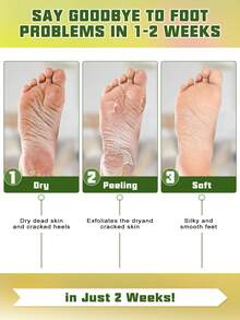 5双装足部去角质面膜 - 蕴含乳酸、尿素和苹果酸，具有去角质、保湿和滋养功效，软化足部粗糙的米色肌肤，令双足丝滑柔嫩 - 精华袜，足部护理，滋养去角质面膜，必备足部护理用品，修脚配件，天然牛油果和芦荟成分，保湿足膜，去除足部死皮 - 白色 - 查看 5