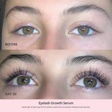 XAPY Eyelash Growth Serum - In-Free Lash Enhancing Serum For Longer Thicker Lashes And Brows-  Form Sible Resul In 2 Weeks - Vegan Hormone-Free 0.10 Fl. Oz/ 3ml - Xám - Xem 5