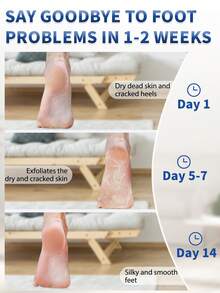 5 Pairs Peach & Aloe Vera Foot Mask - Exfoliating Foot Mask, Moisturizing & Nourishing With Lactic Acid, Urea & Malic Acid For Rough & Dry Feet,Foot Care,Nourishing, Exfoliating Mask,Foot Care Essentials,Foot Mask For Dead Skin Removal Foot Care, Pedicure Product & SPA , Merry Christmas Gift