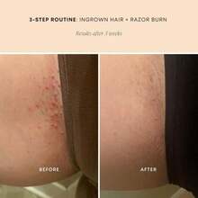 Bushbalm Ingrown Hair And Razor Bumps 2 Step Routine - Moisturize And Soothe - Nude Ingrown Hair Oil (30 Ml), Nude Exfoliating Scrub (236 Ml) - Nude - ColorB - View 3