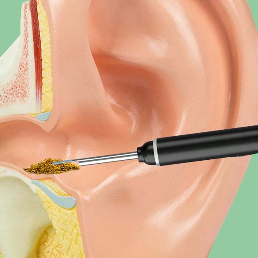 Ear Wax Remover, Ear Wax Cleaner With Camera, Ear Wax Removal Cone With Tweezers, Cleaning Kit, Ear/Nose/Throat Examination Tool With Household Light, Ear Wax Removal Tool With 8 Earplugs - Ear Canal Cleaner With 1296P Camera - màu đen - Xem 1