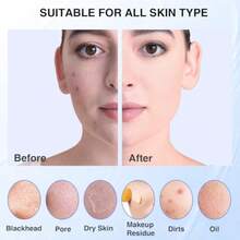 XAPY 5 Modes Silicone Face Scrubber Of Face Scrubber Eolia For Men And Wen Rechargeable Electric Facial Cleansing Br For Deep Cleansing Eoliating Mas Blue - Màu xanh lam - Xem 6
