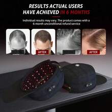 Laser Cap, Laser Red Light Therapy For Hair Growth System, Hair Thinning & Alopecia Treatment For Men & Women, Laser Cap For Hair Regrowth Stimulates Denser Fuller Hair - 1 - 查看 7