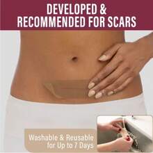 Nuvadermis Medical Grade Water Resistant Reusable Silicone Scar Sheets - Clear - 4ct - White - View 5