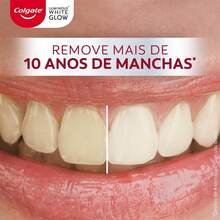 Pasta Dental Blanqueadora Luminous White Glow 70 g, Remueve 10 Años de Manchas*, con 3% de Peróxido de Hidrógeno,  para el Esmalte Dental - 1 - Ver 8