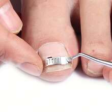 3pcs Adjustable Stainless Steel Ingrown Toenail Clips, Pedicure Nail File And Tape, Foot Care Tools - Beige - View 7