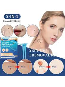 2In1 Auto Skin Warm Removal Kit Painless Mole Wart Remover Equipment Micro Skin Warm Treatment Easy To Clean Skin Care - 1件 - 查看 1