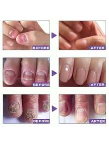 Nail Care Tools, Foot Nail Nourishment Removal And Repair Tools, Foot Nail Care Tools - 1件 - 查看 3