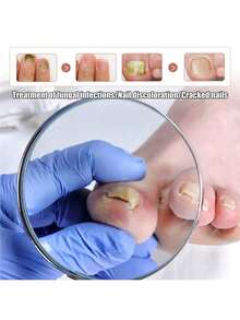 Let You Have Healthy Nails - 1 Item - View 6