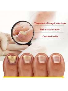 Let You Have Healthy Nails - 1 Item - View 5
