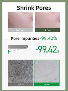 Anua 150毫升鱼腥草深层清洁泡沫，洁面乳，双重清洁，蕴含BHA、玻尿酸、甘油，可去除黑头，韩国护肤品，韩妆 - 150ml - 查看 2