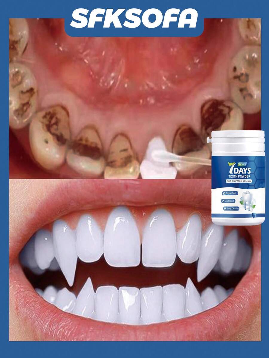 7天美白牙粉 | 亮白、保护牙龈、深层清洁、恢复口腔亮泽 - 彩色 - 查看 1