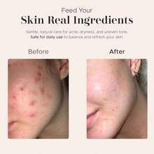 Era Of Nature Best Raw ORGANIC AFRICAN BLACK SOAP, For Dry Skin And Skin Conditions. Pure &Amp; Natural Ingredients, Imported From Ghana - 8oz - MàuD - Xem 6