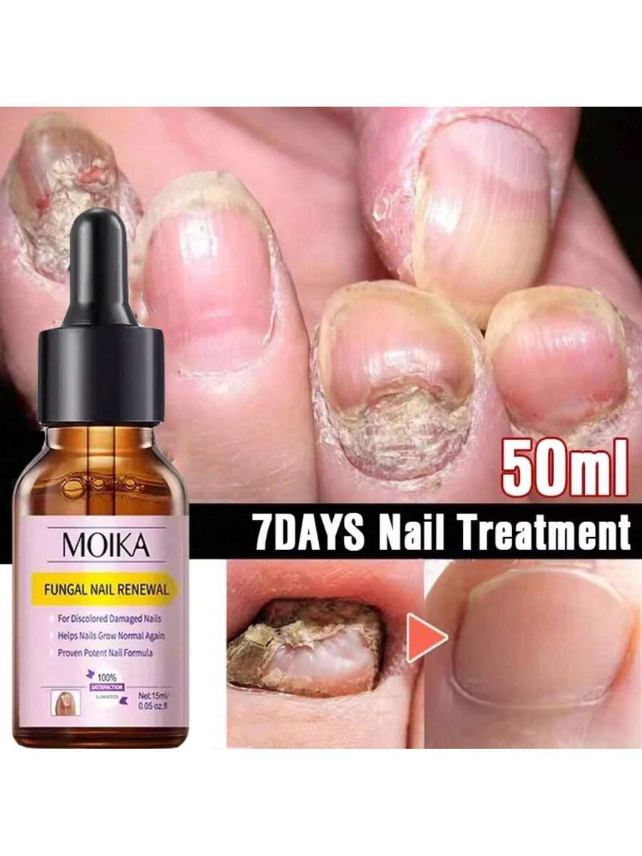 Nail Care Tools, Foot Nail Nourishment Removal And Repair Tools, Foot Nail Care Tools - 1件 - 查看 1