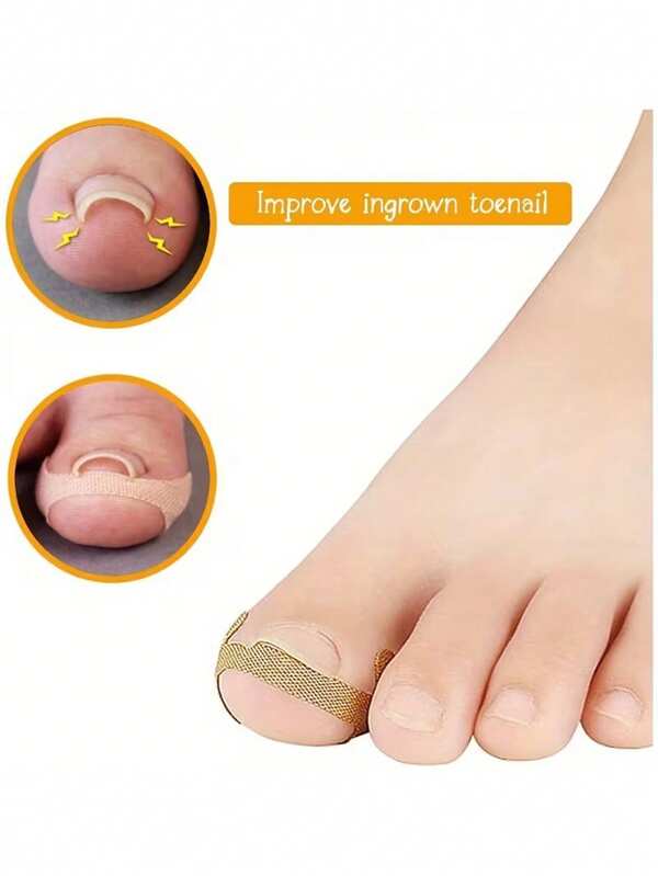 100pcs Painless Ingrown Toenail Corrector, Improve Nail Groove Inflammation, Suitable For Foot Care, Suitable For Men And Women Daily Use