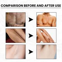 Gentle Hair Removal Cream - Mild, Non-Irritating, Full Body Hair Removal, Refreshing, Moisturizing, Smooth, Suitable For Men And Women - White - View 7