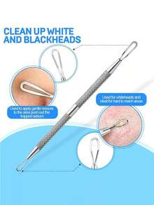 2pcs Blackhead Remover Tool Kit, Acne Treatment Tool, Professional Grade Blackhead & Pimple Extractor, Facial Nose Blackhead Removal Squeezers - Multicolor - View 2