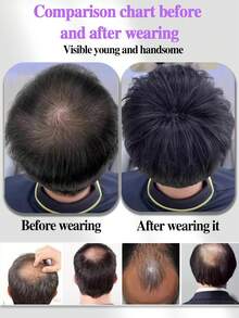 1件男士真人发假发 - 18x20/16x18厘米，男士自然逼真补发假发，隐形翻盖设计，适用于脱发/头发稀疏，佩戴牢固，适合日常及特殊场合，兼容所有浅米色调，男士假发，高品质假发，脱发解决方案，无缝融合，经久耐用，#1B - Natural Black - 查看 6