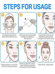 2pcs Blackhead Remover Tool Kit, Acne Treatment Tool, Professional Grade Blackhead & Pimple Extractor, Facial Nose Blackhead Removal Squeezers - Multicolor - View 4